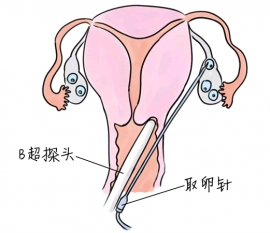 幼儿学画画，福州捐卵宝宝学画画，学画画的好处，如何学画画